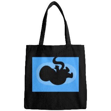 Discover Baby Ultrasound Medical Doctor Bags