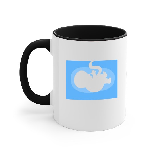 Baby Ultrasound Medical Doctor Accent Mugs