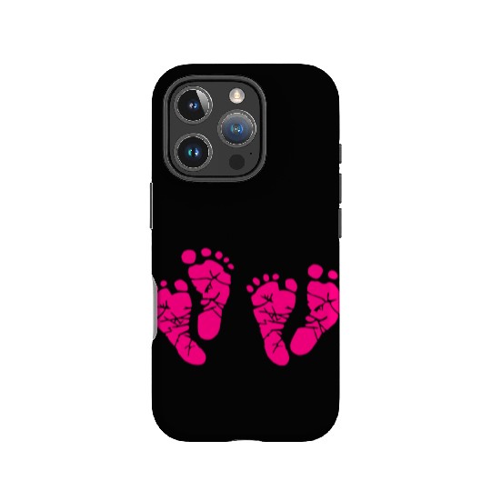 Twin Baby Feet - Pregnancy - Maternity - Mom to be IPhone Cases