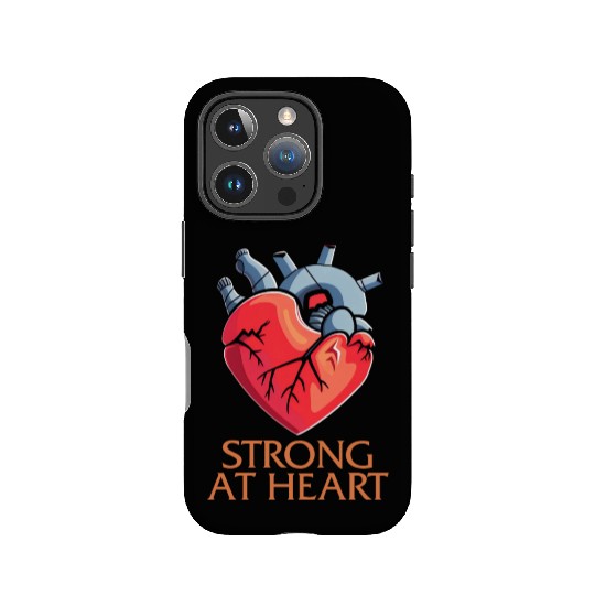 CHD Awareness IPhone Cases, Strong At Heart Pumping Iron