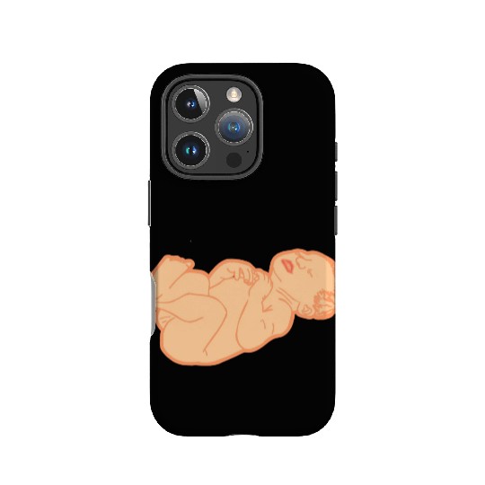 Newborn baby white skin color IPhone Cases