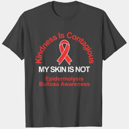 Kindness Is Contagious, My Skin Is Not Apparel T Shirts