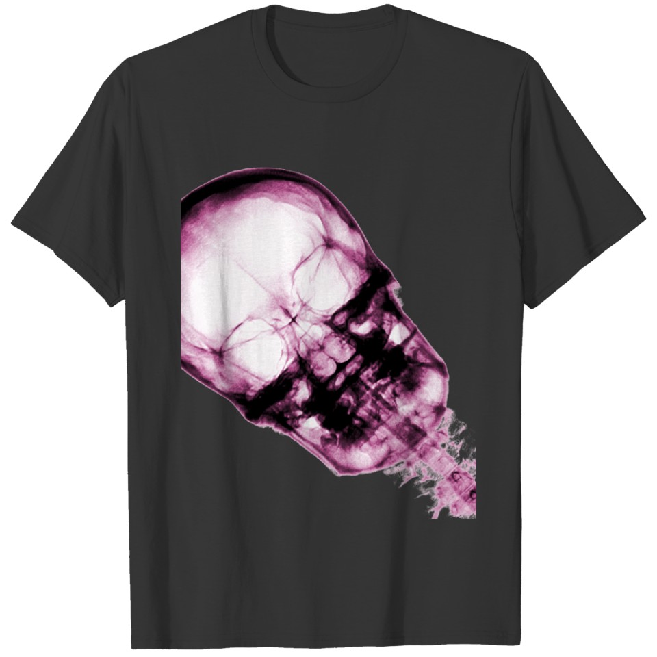 Pink X-Ray Vision Skeleton Skull T-shirt